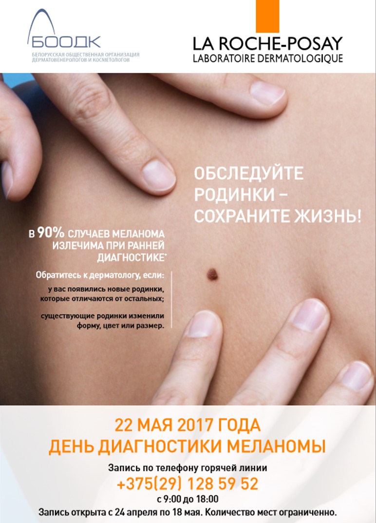 22 мая в Беларуси впервые пройдет Международный День Диагностики Меланомы